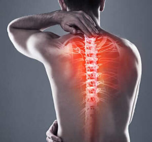 Pinched Nerve in Neck or Back
